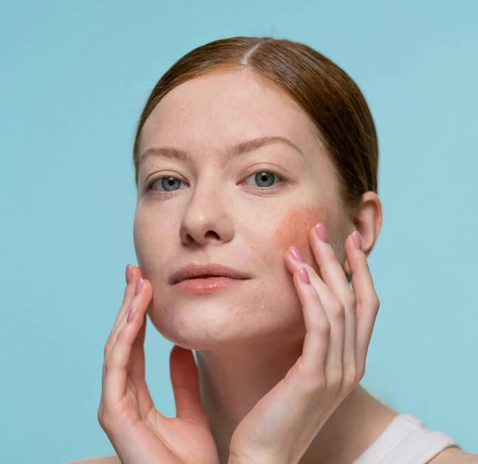 Boyfriend Blush make-up trend.